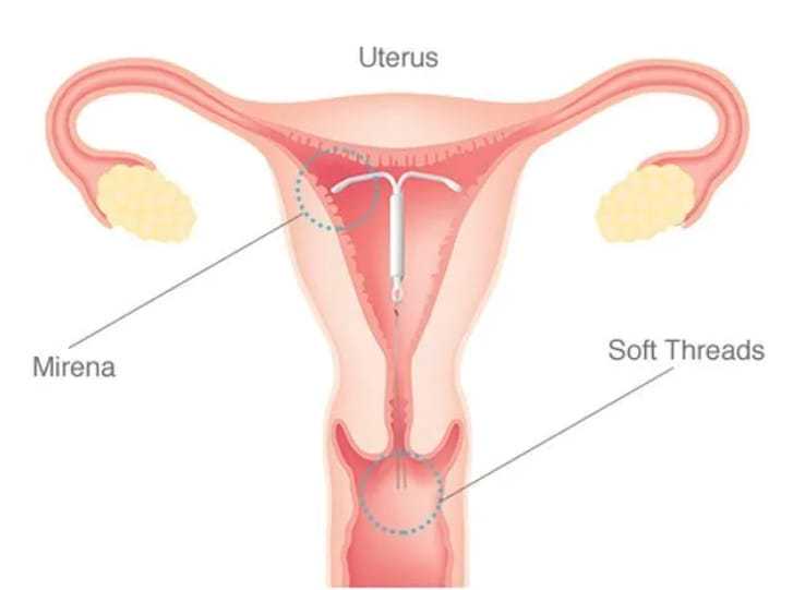 供卵代怀-怀孕被公司辞退怎么办