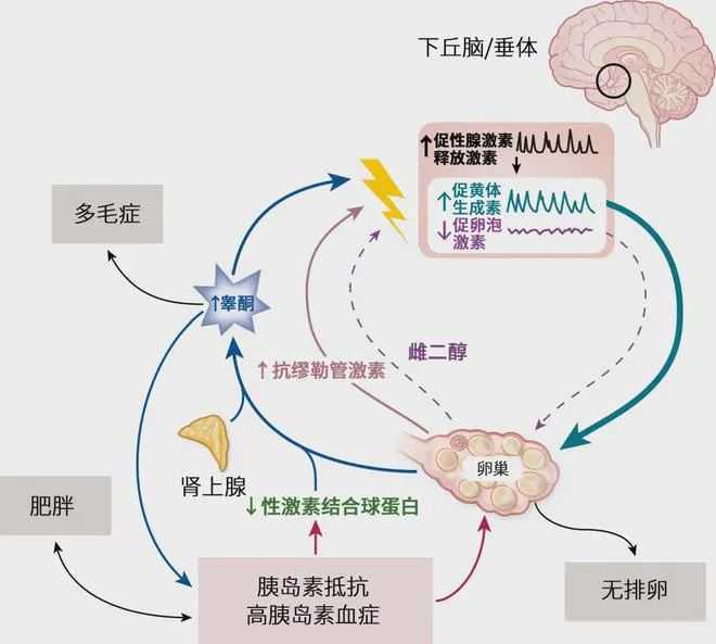 代怀微信-21岁会不会得子宫内膜异位症-20岁的子宫内膜异位是怎么引起的