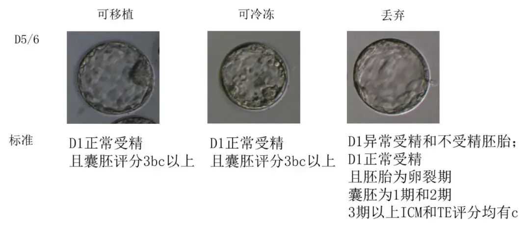 供卵代生-阴道囊肿会影响怀孕吗(宫颈纳囊会影响怀孕吗)