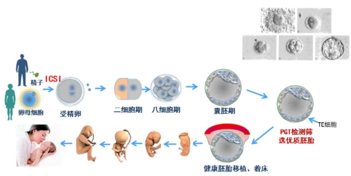 汗蒸能去除体内湿气寒气吗？有哪些注意事项？