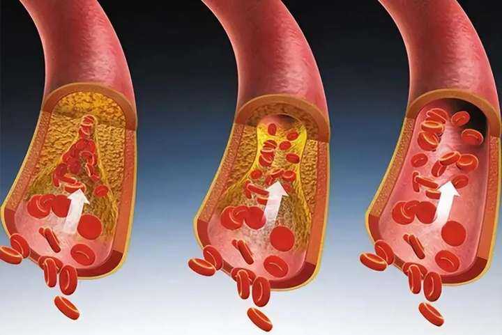 代生费-怀孕前是否可以摄入含咖啡因的食品？