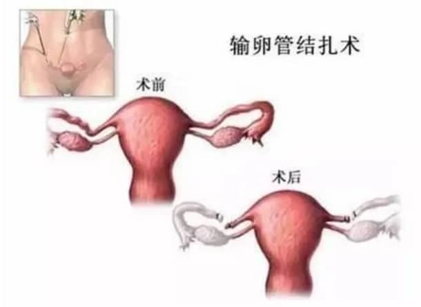 代生求子-怀孕后补叶酸，还来得及吗？