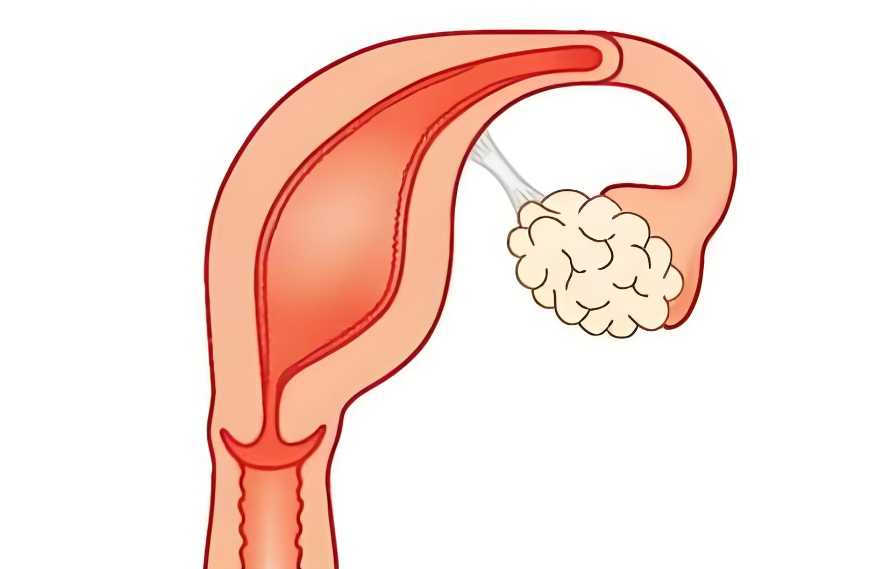 代怀价格-做第三代试管婴儿基本上不会胎停吗？