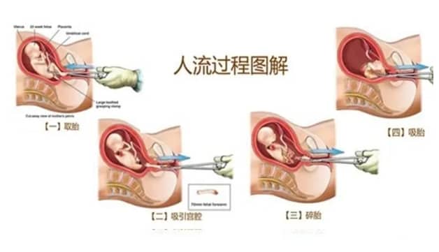 助孕生子-女性月经推迟的原因(未婚女性月经推迟的主要原因)