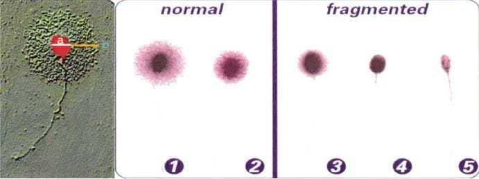 包生男孩-湖北单身女性人工授精(单身女子人工授精)