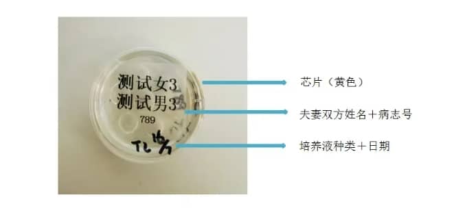 代怀微信-无痛取卵真的不痛吗