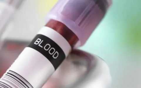 做人工助孕是不是不能同房？人工助孕后同房了怎么办？