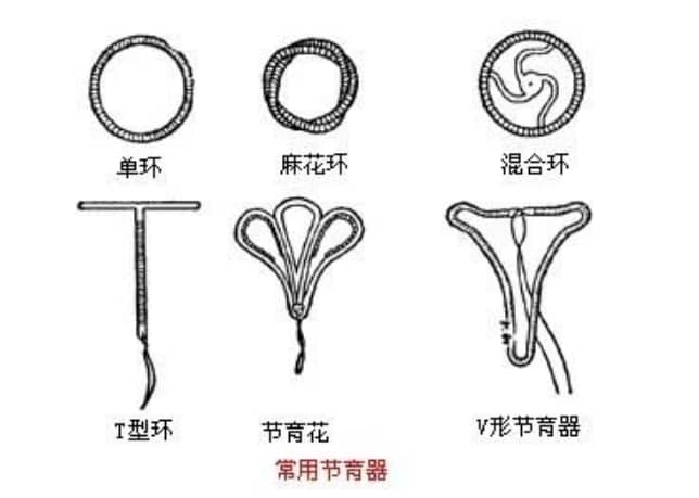 供卵代生-宫外孕hcg值越高越危险