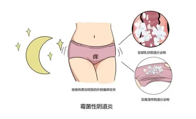 包成功-肌壁间子宫肌瘤怎么治？宫底肌壁间子宫肌瘤的危害