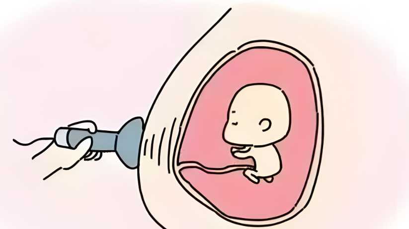 代怀-供精试管婴儿的方案有哪些