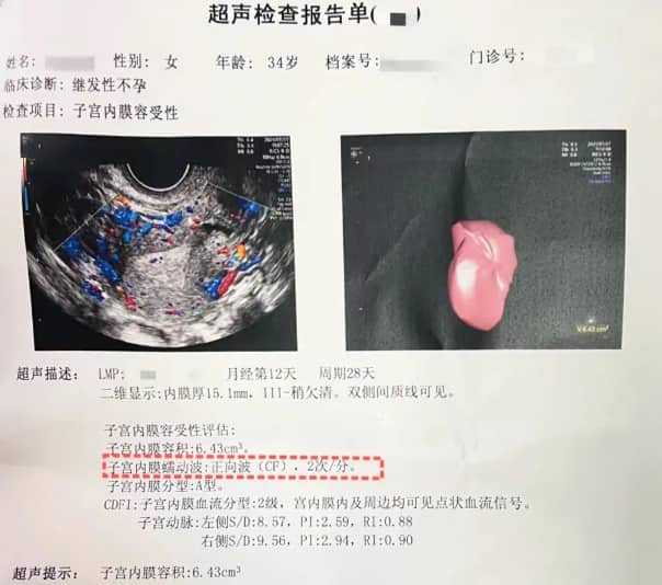 代怀男孩-多囊卵巢综合征是OHSS高危人群,轻度/中度/重度治疗策略大不同