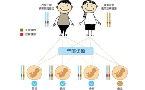 宫颈小息肉可以做试管吗,宫颈小息肉可以做试管吗多少钱