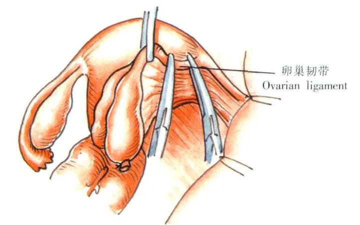 代孕公司-有子宫肌瘤能吃维生素e
