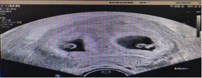 助孕生子-孕期首次产检主要项目是什么？