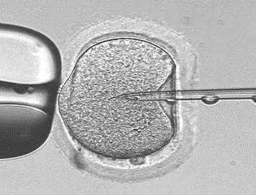 助孕男孩-试管婴儿移植后出血正常吗？试管婴儿移植后尿频正常吗