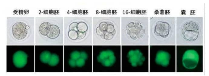 代生求子-多囊卵巢综合征如何检查确诊