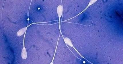 代怀男孩-白带异常与性生活的联系