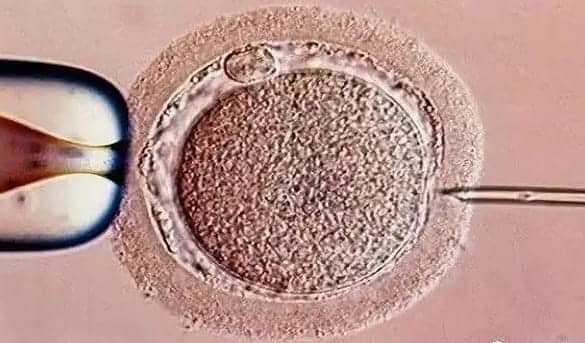 助孕男孩-子宫内膜息肉最怕4种食物，这些食物患者一定要谨慎食用