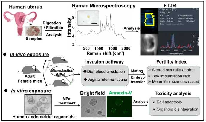 包生男孩-宫腔粘连患者做泰国试管婴儿成功率有多高
