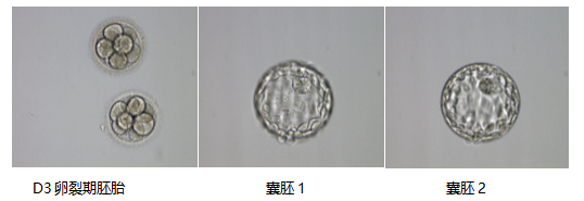 助孕生子-阴道有鱼腥味