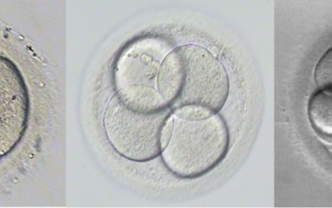生儿子-囊胚培养不成功也要收费吗
