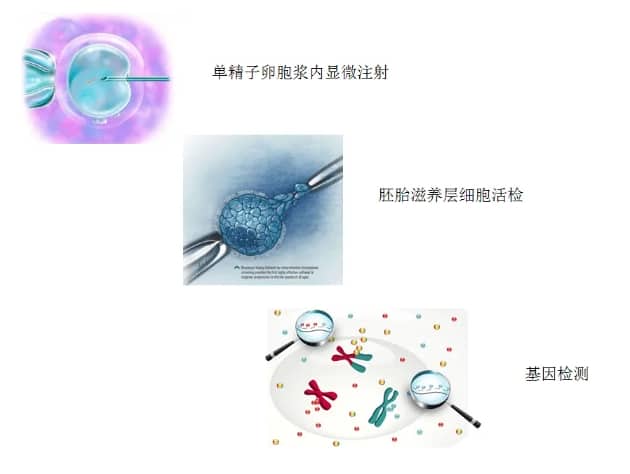 供卵代生-多囊卵巢日常调理方法汇总,多囊卵巢综合症的日常调理
