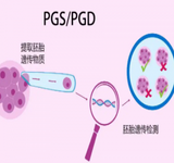 做试管婴儿染色体有问题