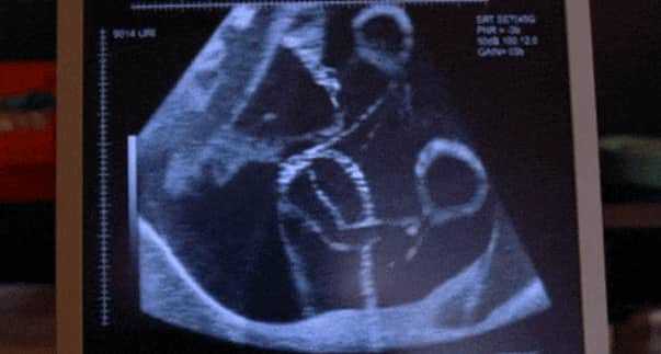 女方年龄影响试管婴儿的成功率的具体原因