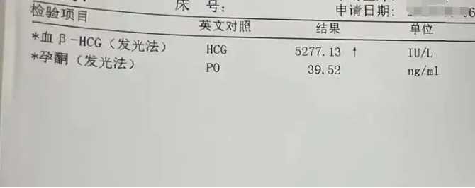 代生求子-女性膀胱b超怎么做