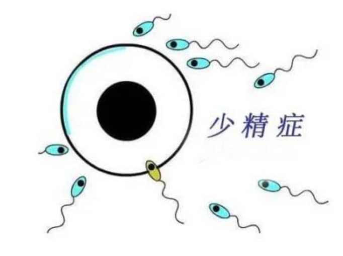 子宫前壁脱垂怎么办