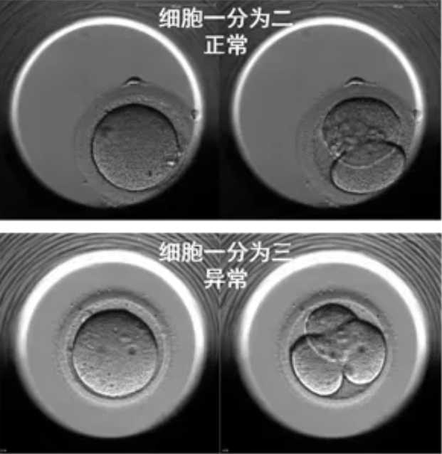 代怀生儿子-备孕补充什么营养素好促进排卵