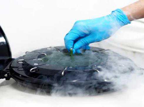 包成功-染色体核型分析是检查什么