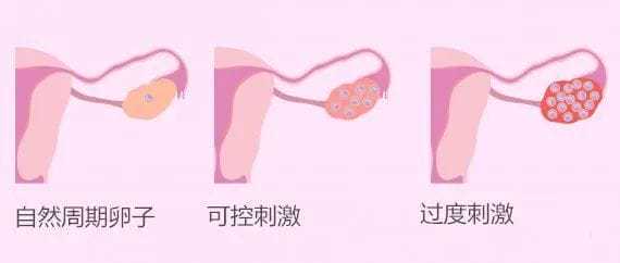 代怀男孩-子宫内膜15a能不能移植