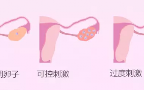 包成功-喉咙痛可以吃牛黄解毒片吗