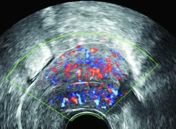 代生价格表-促卵泡激素过低能生育吗？促卵泡激素过低治疗方法