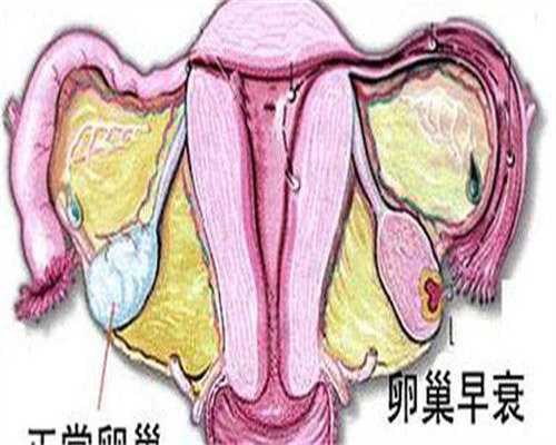 珠海高龄女性不孕?拉拉同志三代试管与供卵代怀全攻略