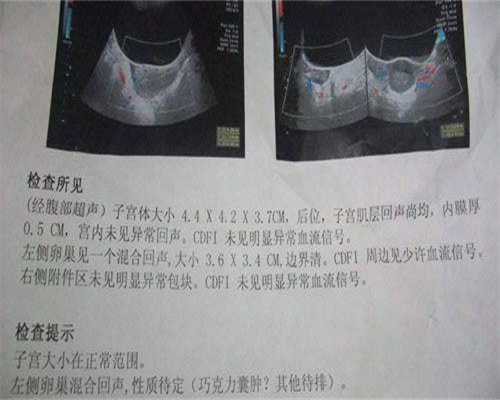 大连拉拉同志福音：脊髓性肌萎缩症试管与供卵三代试管全攻略