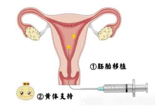 太原拉拉AMH检查不孕指南:代生代怀与供卵三代试管选择