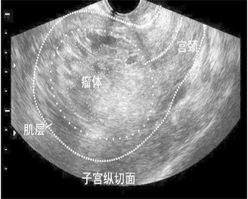 惠州不孕不育医院指南：代生代怀、选性别与供卵三代试管全解析