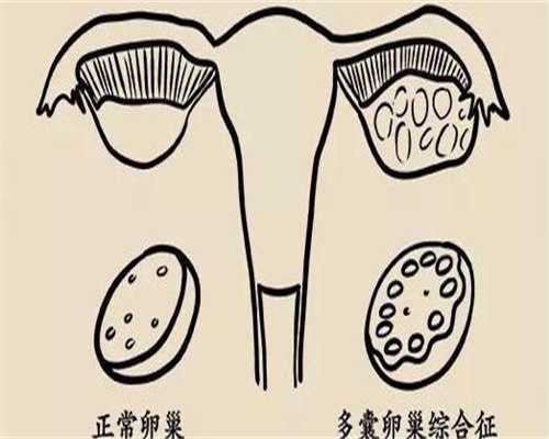 盐城不育治疗新选择：代生代怀、选性别与供卵三代试管详解
