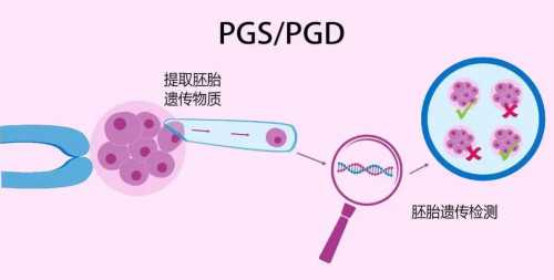 宿迁单身女性卵巢功能低下不孕,三代试管代怀供卵选性别全攻略