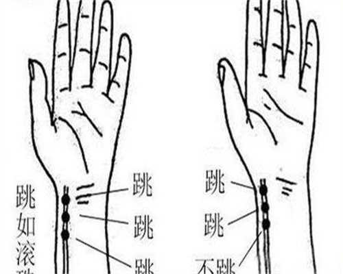盐城盆腔炎不孕？选性别供卵三代试管助孕方案