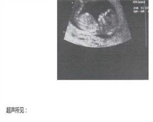 金华拉拉血精症不育？代生代怀选性别供卵三代试管全攻略
