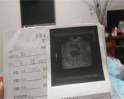 盐城高龄备孕必看：精子存活率检查与代生代怀三代试管指南