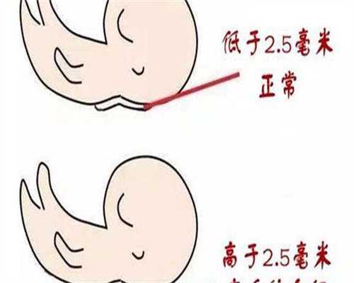 珠海拉拉三代试管:子宫内膜活检助孕,供卵选性别全解析