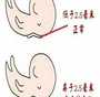 珠海拉拉三代试管：子宫内膜活检助孕，供卵选性别全解析