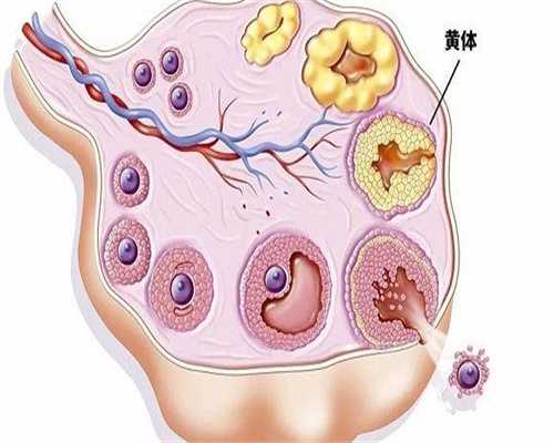 宿迁多囊卵巢综合征试管攻略：代生代怀、选性别、供卵三代试管全解析