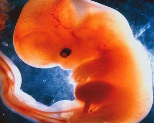 西安双角子宫试管攻略:代生代怀与供卵三代试管全解析