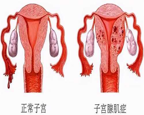 高龄女性试管婴儿成功案例：42岁自卵双胎经验
