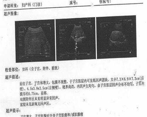 西安拉拉同志女性不孕治疗：代生代怀、供卵三代试管全攻略